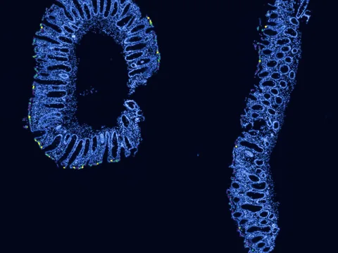 Human rectum preview