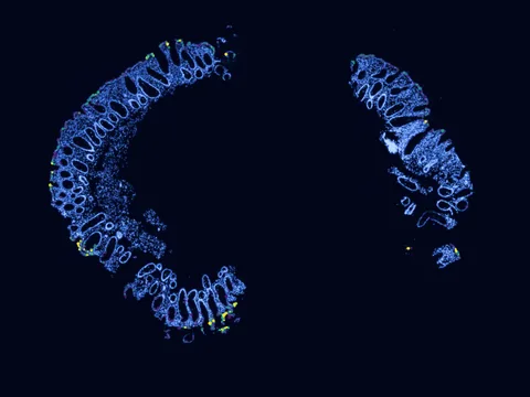 Human rectum preview
