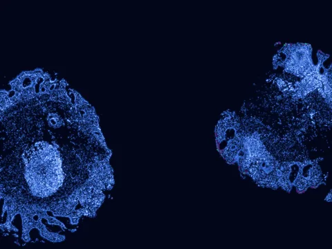 Human rectum preview