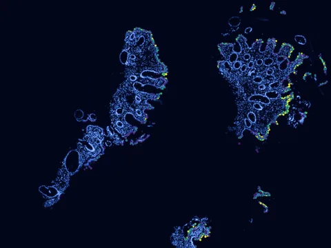 Human rectum preview