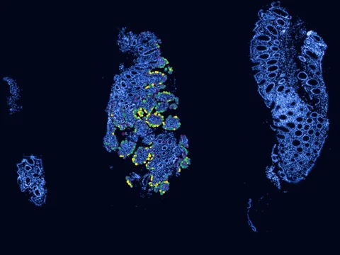 Human rectum preview