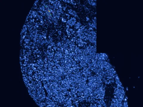 Human skin of body preview