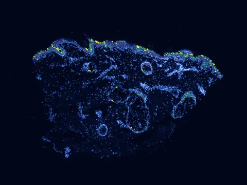 Human skin of body preview