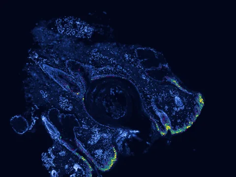 Human skin of body preview