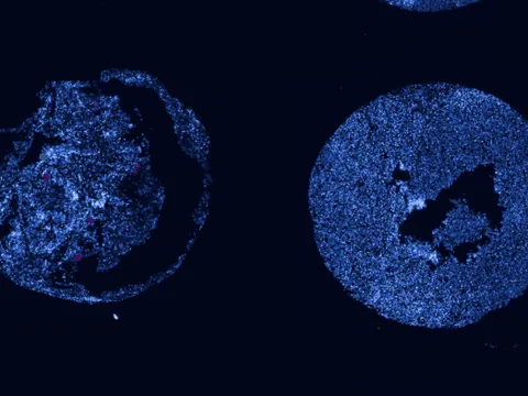 Human skin of body preview
