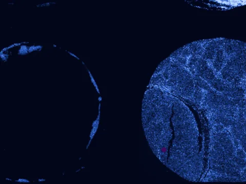 Human skin of body preview