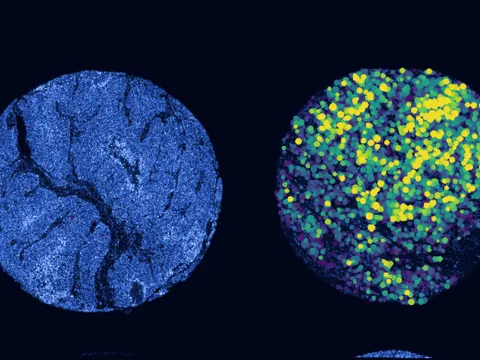 Human skin of body preview