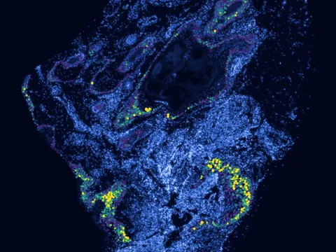 Human skin of body preview