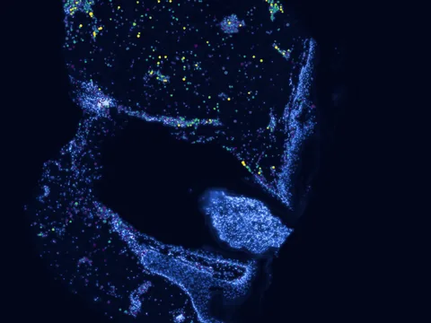 Human skin of body preview