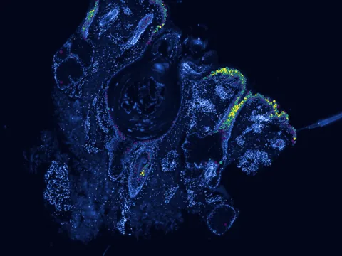 Human skin of body preview