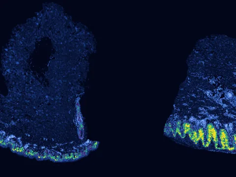 Human skin of body preview