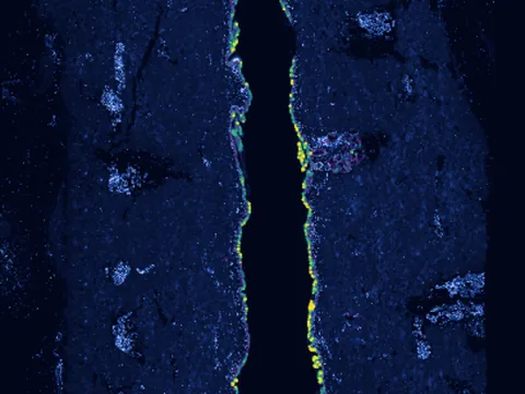 Human skin of body preview