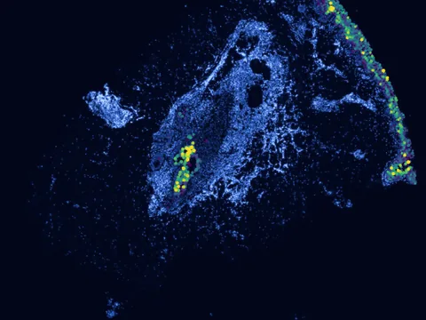 Human skin of body preview