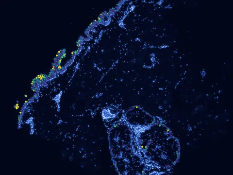 Human skin of body preview