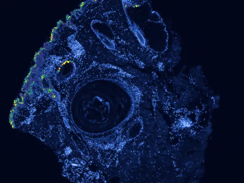 Human skin of body preview