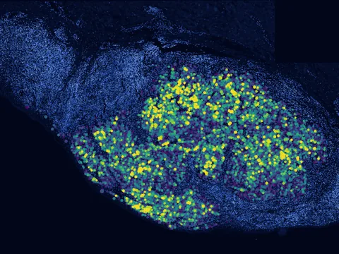 Human skin of body preview