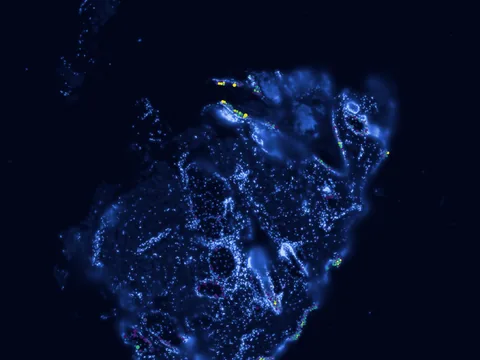 Human skin of body preview
