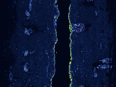 Human skin of body preview