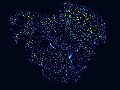 Human subcutaneous adipose tissue preview