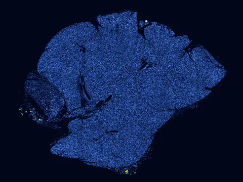 Mouse submandibular gland preview