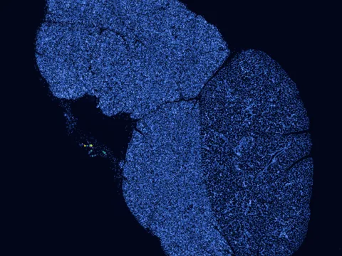 Mouse submandibular gland preview