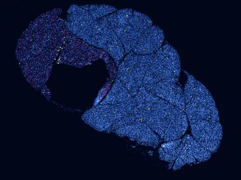 Mouse submandibular gland preview