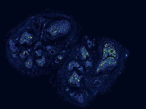 Human sural nerve preview