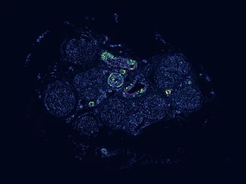 Human sural nerve preview