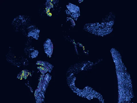 Human synovial membrane of synovial joint preview