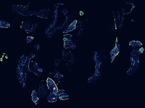 Human synovial membrane of synovial joint preview