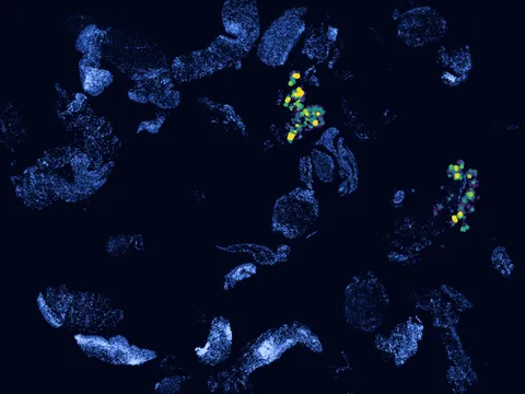 Human synovial membrane of synovial joint preview