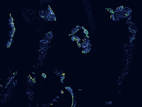 Human synovial membrane of synovial joint preview