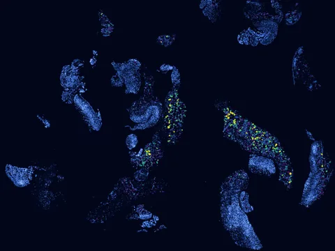 Human synovial membrane of synovial joint preview
