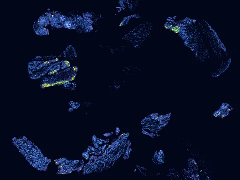Human synovial membrane of synovial joint preview