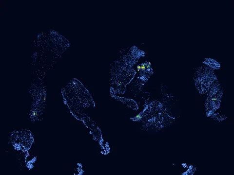 Human synovial membrane of synovial joint preview