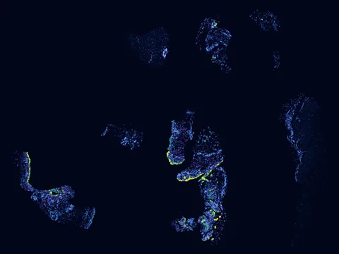 Human synovial membrane of synovial joint preview