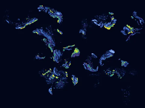 Human synovial membrane of synovial joint preview
