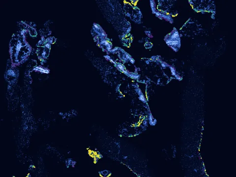 Human synovial membrane of synovial joint preview