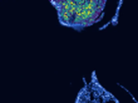 Leucoraja erinaceus trunk preview