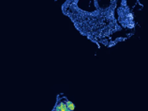 Leucoraja erinaceus trunk preview