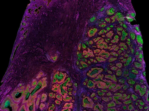 Human uterine cervix preview