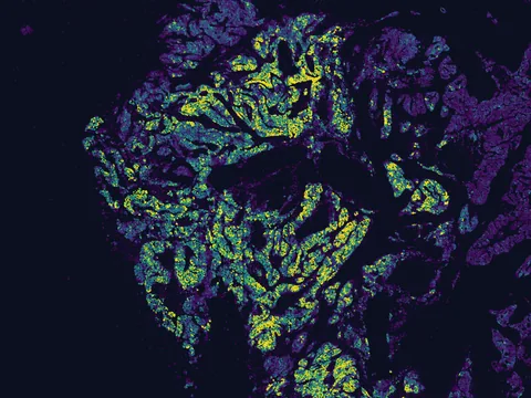Human breast preview