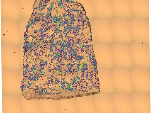 Human kidney preview