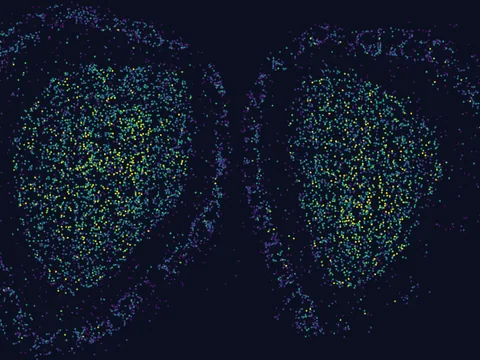Mouse brain preview