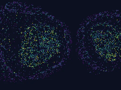 Mouse brain preview