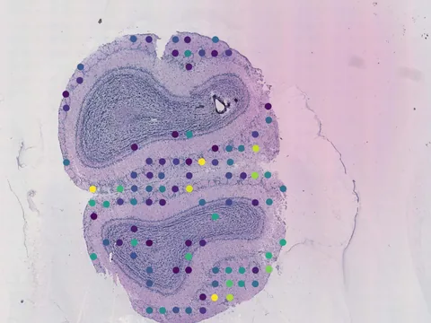 Mouse brain preview