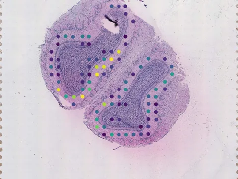 Mouse brain preview