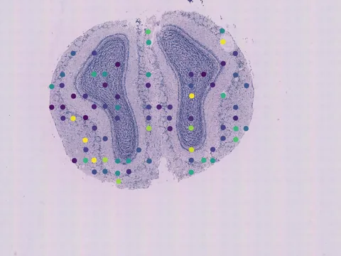 Mouse brain preview