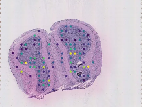 Mouse brain preview