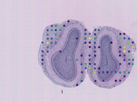 Mouse brain preview